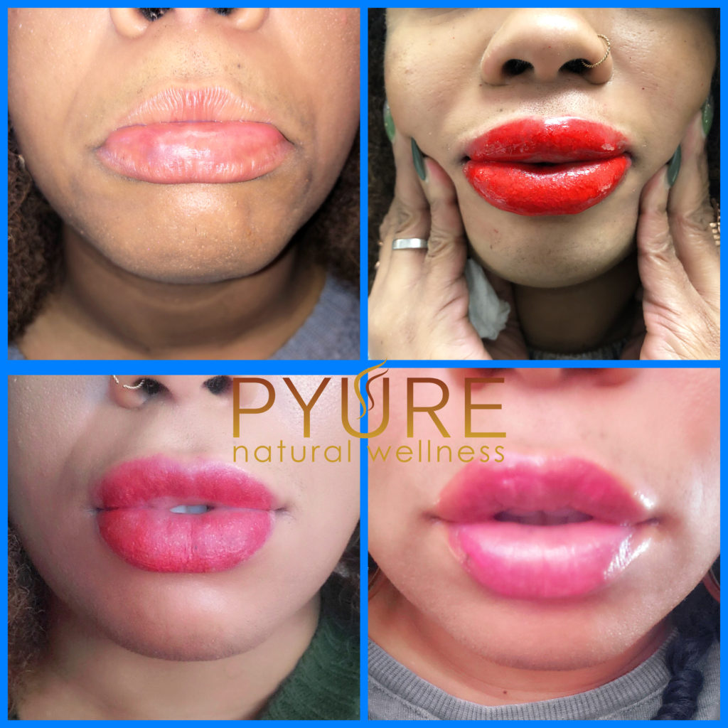 Pyure Natural Wellness IMG_1566-1024x1024 Lip Tinting- Ombre' Lip Blushing  