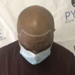 Pyure Natural Wellness IMG_9268-150x150 Scalp Micropigmentation (SMP)  Gallery  